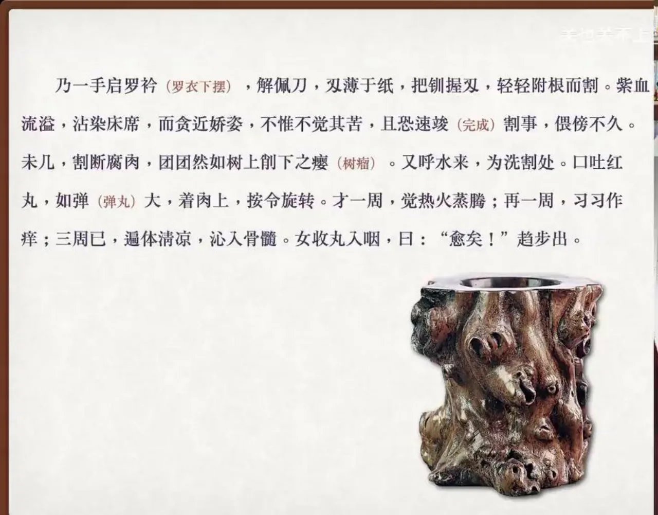 关也《娇娜》课件第30页：割除病灶与木瘿比喻