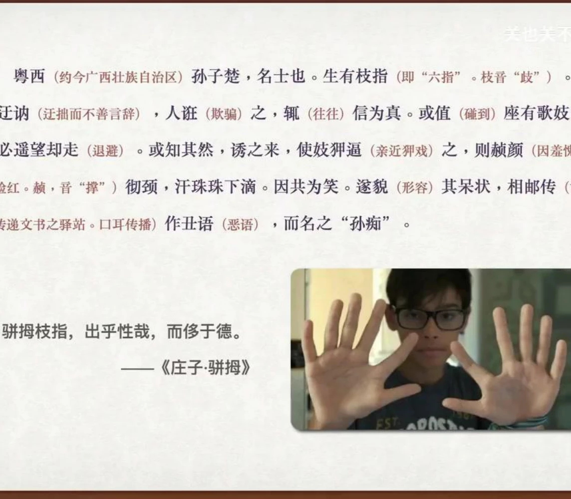 关也《阿宝》课件第4页：枝指的手部示例